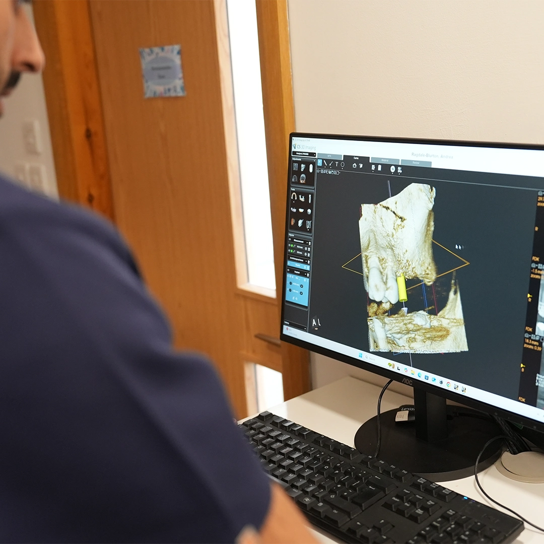 The Role of 3D Imaging in Planning Your Dental Implants