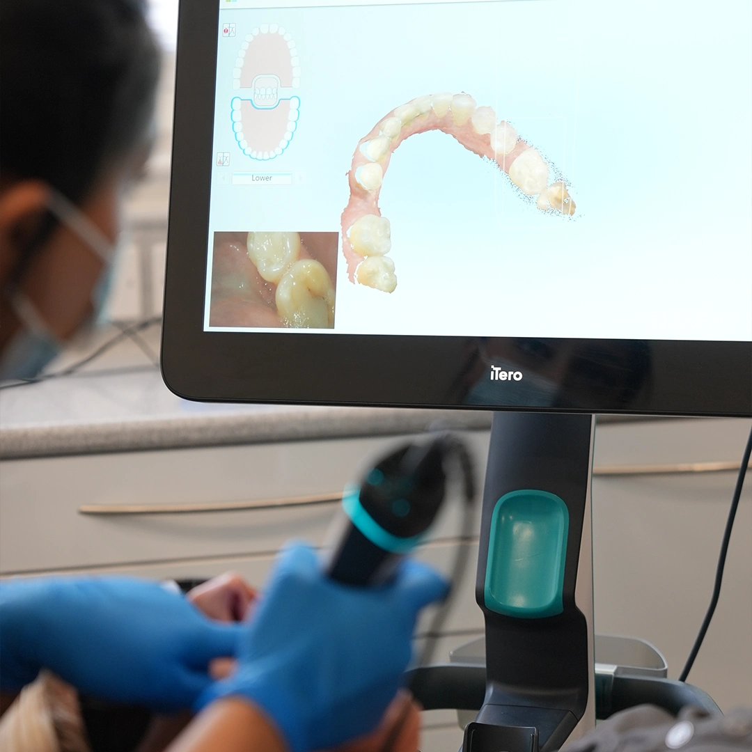How Digital Dentistry Makes Smile Makeovers More Predictable